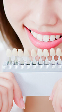 ホワイトニング