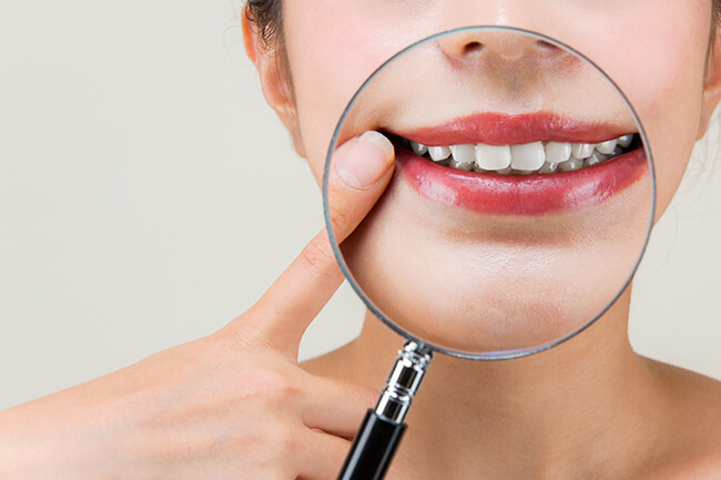 当院の審美歯科の特徴