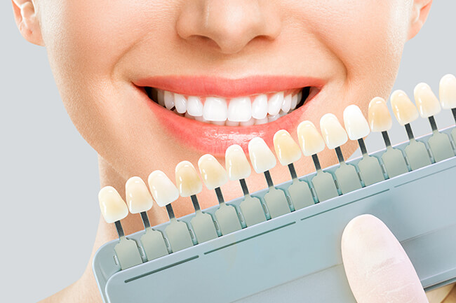 当院のホワイトニングの特長
